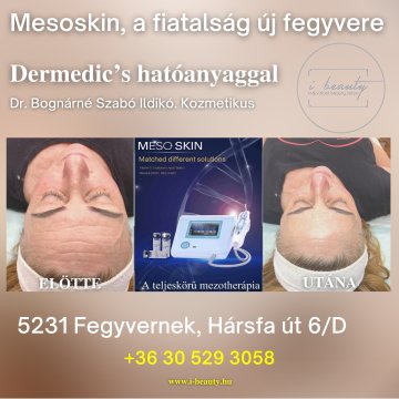 Ez a kezelés olyan vendégeknek szól, akik izgalmas, trendi
