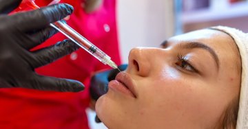 Az ajakfeltöltés fogalma már mindenki számára ismerős
