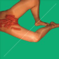 Rub (Remixed) LP